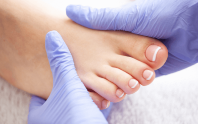 Why Regular Podiatry Visits Are Essential for Londoners