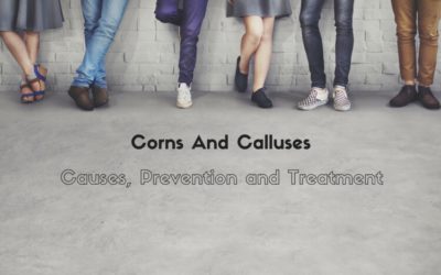 Corns And Calluses: Causes, Prevention and Treatment