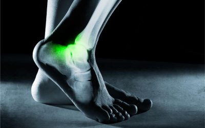 Make Time for Ankle Strengthening Exercises