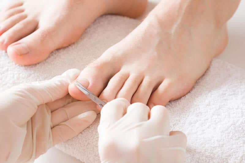 CUTTING AND TRIMMING SUPER THICK TOENAILS!!! ***HOW TO MANAGE HARD TO CUT  TOENAILS*** 