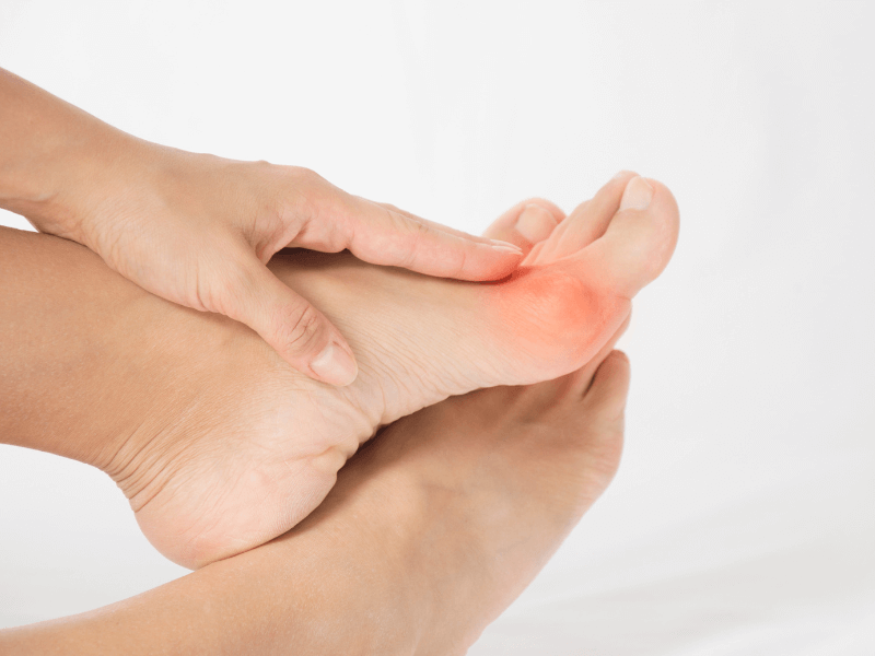 Bunion Care – Dos and Don’ts